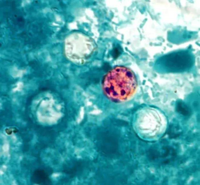 Michigan sees explosive outbreak of diarrheal parasite with over 700 cases