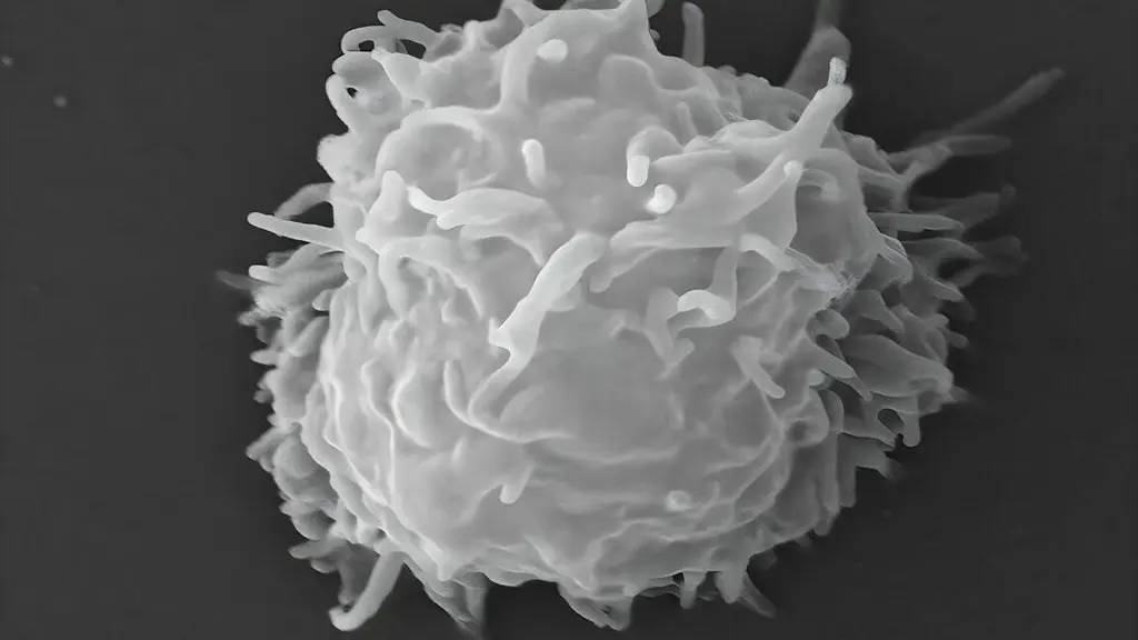 Amoebas eat man alive over months in puzzling, ultra-rare cautionary tale