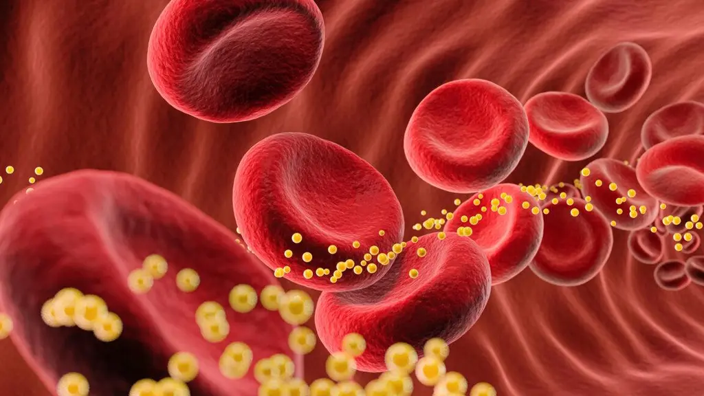 One dose of gene-editing drug cut bad cholesterol 62% for months in small trial
