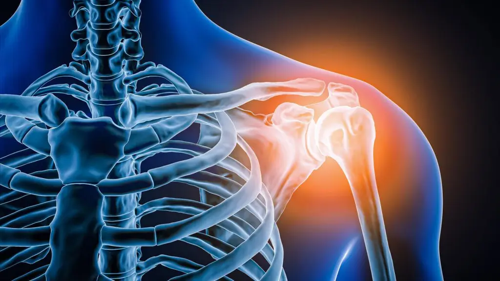 Doctors took a look at man's painful shoulder—they found the joint was missing