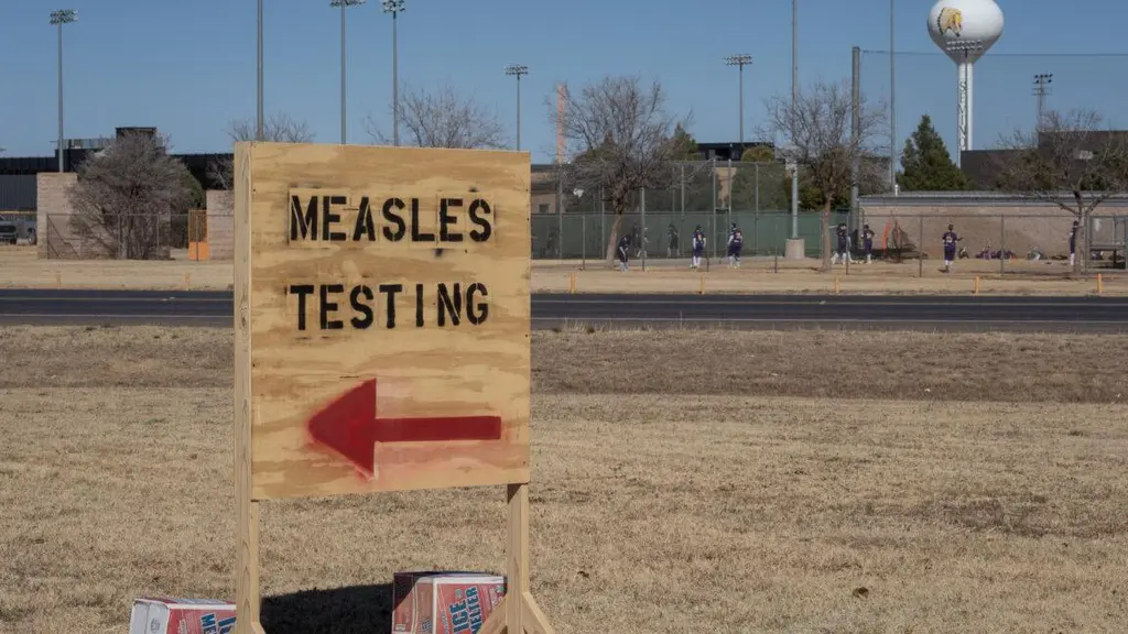 As US measles cases rise, biotech firms start developing new treatments