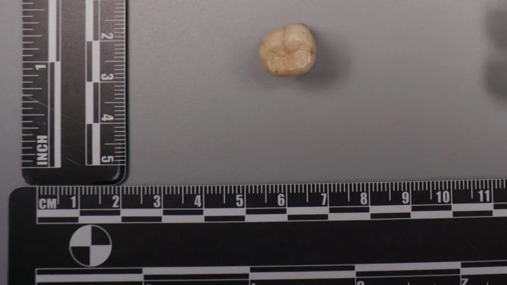 Protein in Homo erectus teeth suggests Denisovans gave us some of their DNA