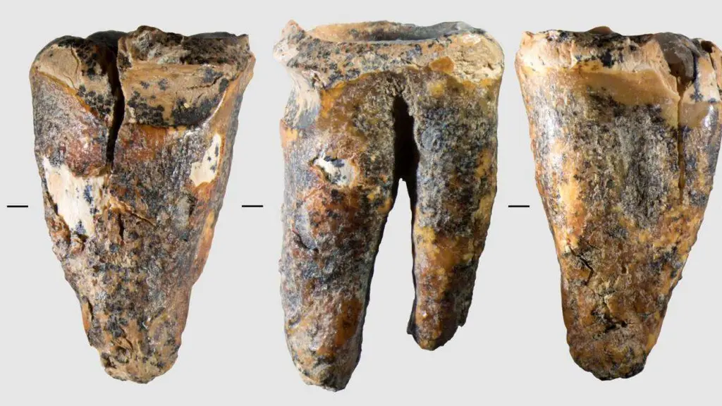 Neanderthals drilled cavities to treat a toothache 59,000 years ago